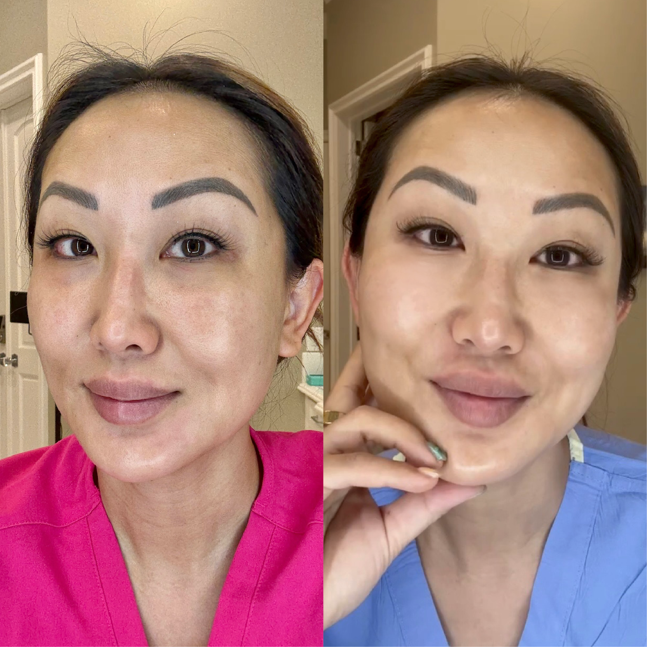 The Illuminating Eye Cream With The Cooling Metal Applicator Tip